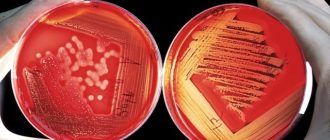 Уничтожение бактерий, микробов